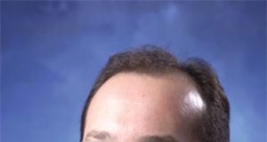 Stem Cell Program at VRIC