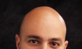 The issue of medical frailty