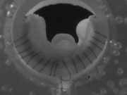 One-year data from VenoValve US pivotal trial emerges