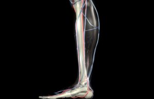 Clopidogrel exposure along with aspirin and rivaroxaban should be ‘minimized or avoided’ in PAD revascularization