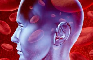 ‘Risk prediction models can be used for targeted screening for asymptomatic carotid stenosis,’ researchers find