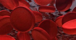 SVS seeks comments on chronic mesenteric ischemia guidelines by July 8