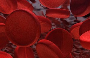 SVS seeks comments on chronic mesenteric ischemia guidelines by July 8