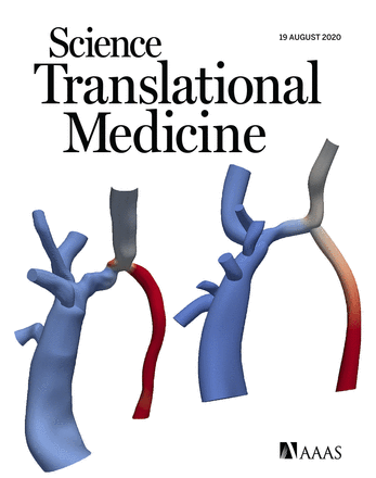 Artery-to-vein AVF technique found to improve hemodynamics, increasing maturation and patency