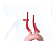 Ascending aorta: Challenges of obtaining data discussed at CX Aortic Vienna