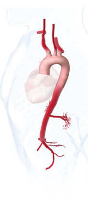 Ascending aorta: Challenges of obtaining data discussed at CX Aortic Vienna