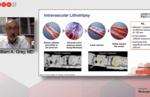 Intravascular lithotripsy ‘superior’ to PTA in acute procedural success out to 30 days