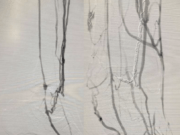 Foot vein arterialization study shows 77.8% limb salvage rate