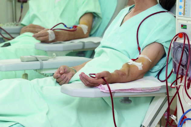 Risk of ‘feared’ ischemic steal syndrome comparable for tapered and non-tapered AVGs