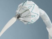 RelayPlus thoracic stent graft post-approval study reports low operative mortality