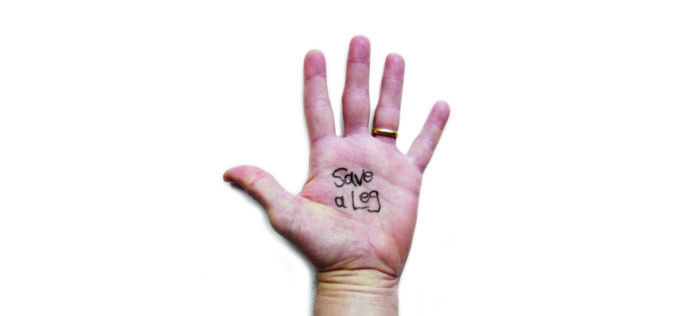 SVS Foundation’s new initiative to address disparities in vascular health