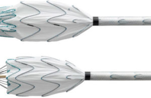 Medtronic recalls unused Valiant Navion thoracic stent graft system