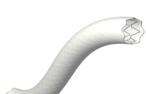 First patient treated in the BeGraft FEVAR study aimed at providing evidence for on-label use