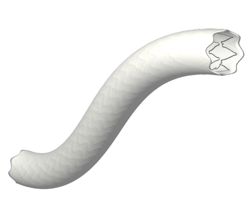First patient treated in the BeGraft FEVAR study aimed at providing evidence for on-label use