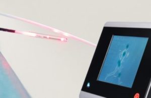 Study: ELVeS Radial varicose vein laser therapy shows ‘excellent’ long-term results