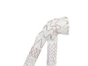 US surgeons begin commercial use of Gore Excluder conformable AAA endoprosthesis with Active Control system