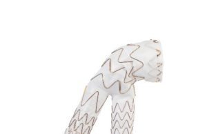 US surgeons begin commercial use of Gore Excluder conformable AAA endoprosthesis with Active Control system