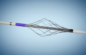 Surmodics builds thrombectomy portfolio with acquisition of Vetex Medical