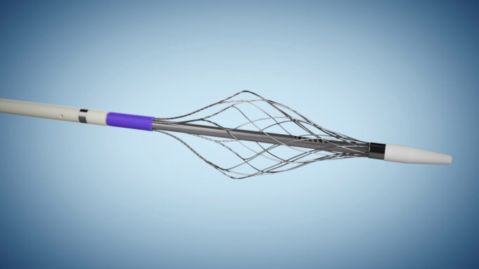 Vetex Medical announces positive one-year outcomes for ReVene thrombectomy catheter