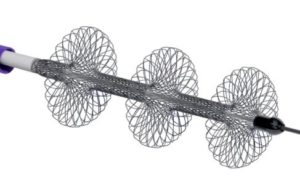 First pulmonary embolism patient enrolled in FLAME study