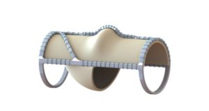 ‘The future is very bright for venous valve replacement’