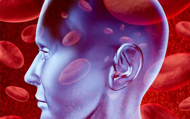Added benefit of carotid revascularization to modern medical care ‘needs to be revisited’, study concludes