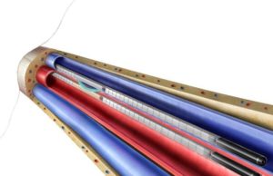 Enrollment starts in postmarket studies of WavelinQ endoAVF system