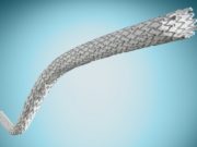 One-year results from PROMISE I study of LimFlow system in ‘no-option’ CLTI patients published