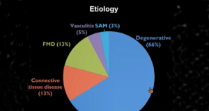 Thirty-year experience indicates SMA aneurysms are ‘relatively stable’