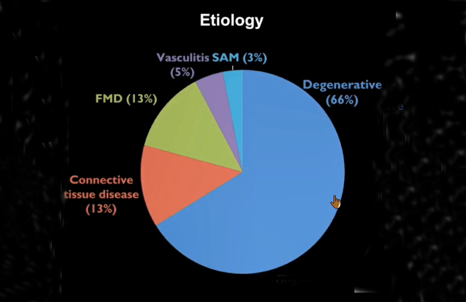 Thirty-year experience indicates SMA aneurysms are ‘relatively stable’