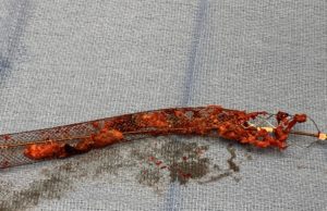 Registry data show greater clot chronicity on post-procedure inspection than initially predicted