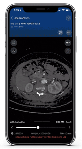 Viz.ai reveals launch of new AI-powered modules for pulmonary embolism, aortic disease