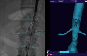 WVS 2022: New evidence of radiation reduction benefit emerges