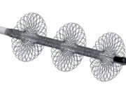 First patient enrolled in PEERLESS study of FlowTriever system