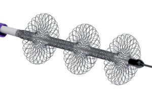 First patient enrolled in PEERLESS study of FlowTriever system