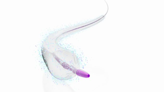 Medtronic gains FDA nod for IN.PACT 018 DCB