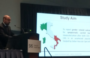 Female sex ‘should be considered an independent risk factor’ for new stroke occurrence after carotid revascularization in symptomatic patients