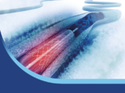 Vascular surgery review book seeks to plug hole in VSITE preparation process