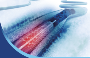 Vascular surgery review book seeks to plug hole in VSITE preparation process