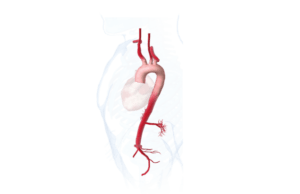 CX Aortic Vienna: Cardiac, vascular surgeons collaborate at the vanguard of aortic care