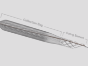 First patient enrolled in DEFIANCE trial of the ClotTriever system in DVT