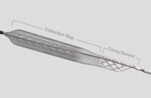 First patient enrolled in DEFIANCE trial of the ClotTriever system in DVT