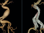 Why 25 years of patient-centered innovation really matters