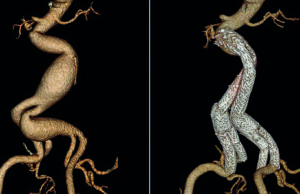 Why 25 years of patient-centered innovation really matters