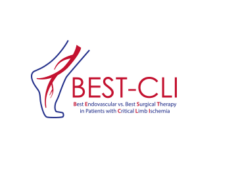 Designated multispecialty CLTI teams may help in amputation fight