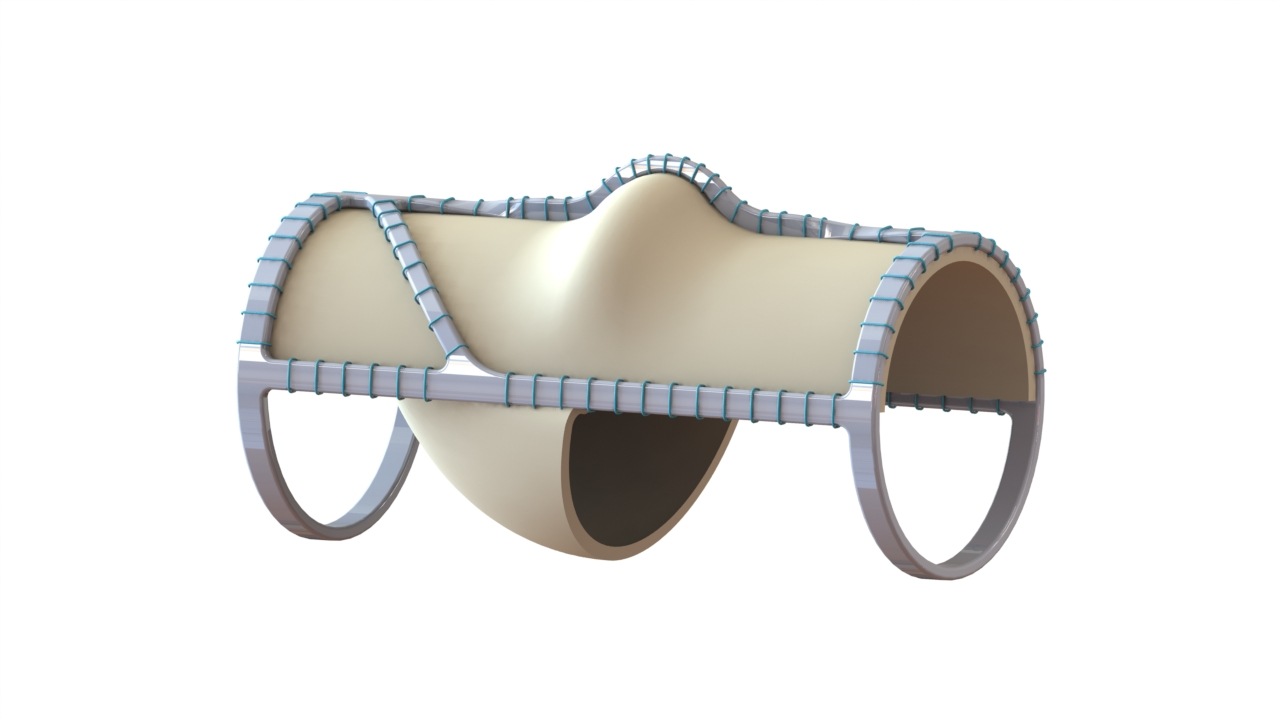 PMA application submitted for VenoValve device