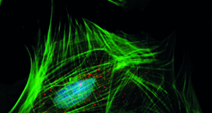 May Vascular Research Initiatives Conference program takes shape