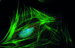 May Vascular Research Initiatives Conference program takes shape