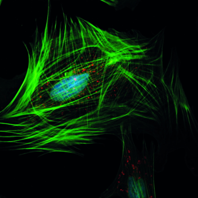 May Vascular Research Initiatives Conference program takes shape