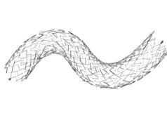 Primary patency after venous stenting best in NIVL patients, study finds